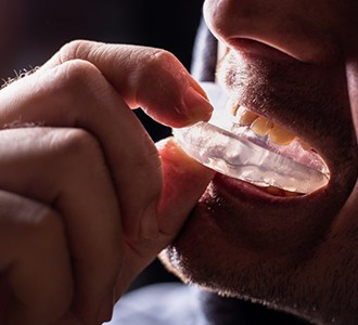 a man putting on a mouthguard for his dental implants